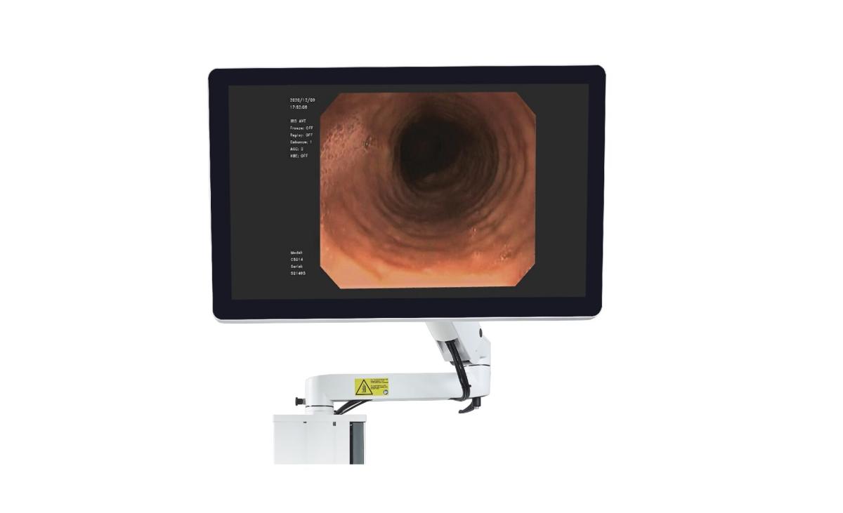 Endoscopy 2