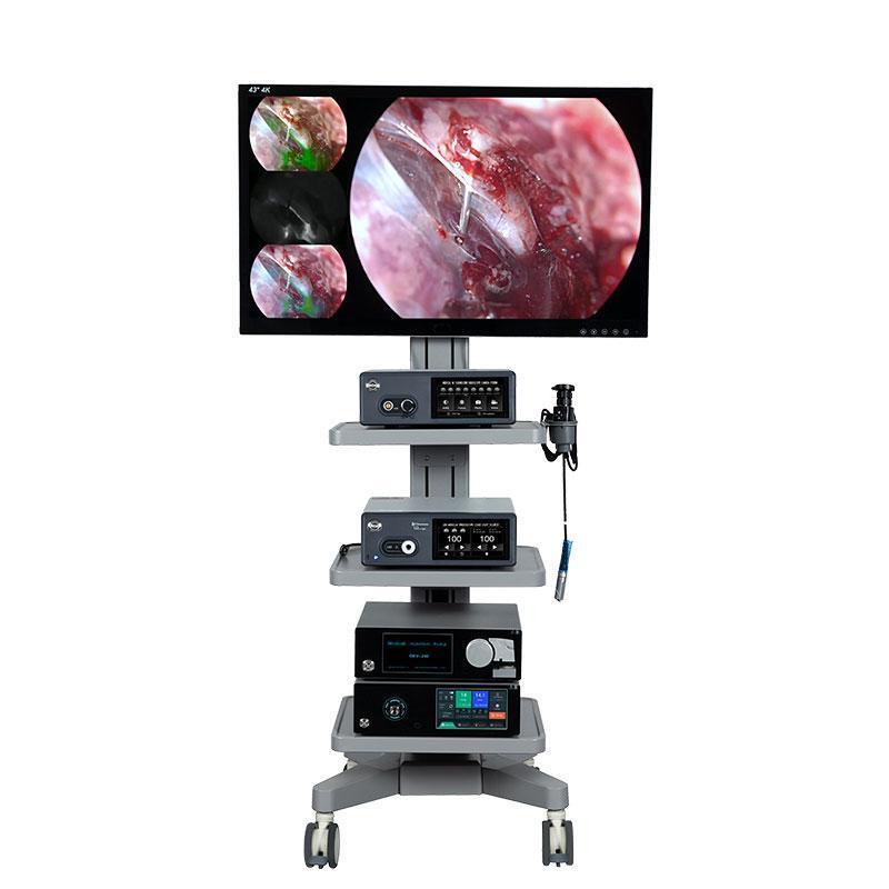 4K Fluorescence Surgical Laparoscopy